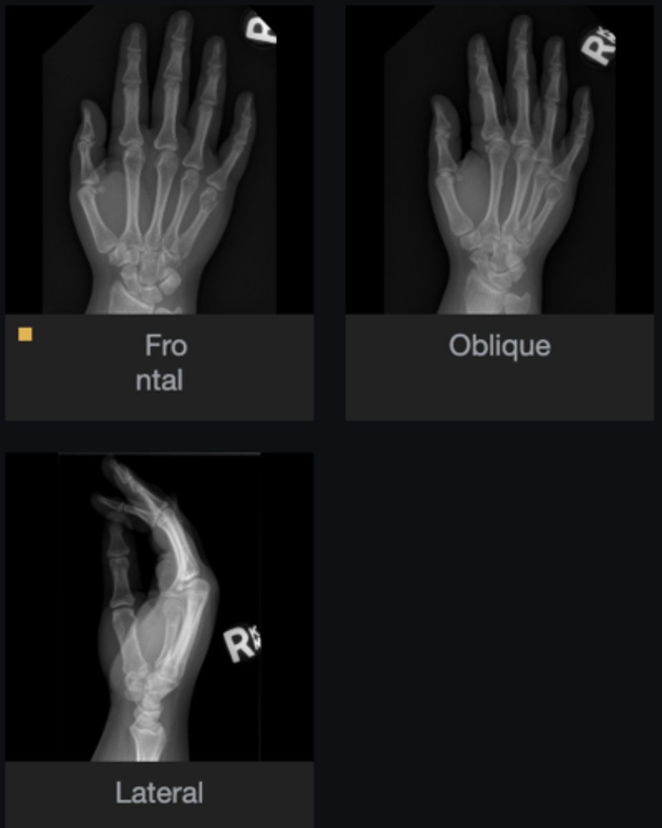 <p>Most likely diagnosis?</p>