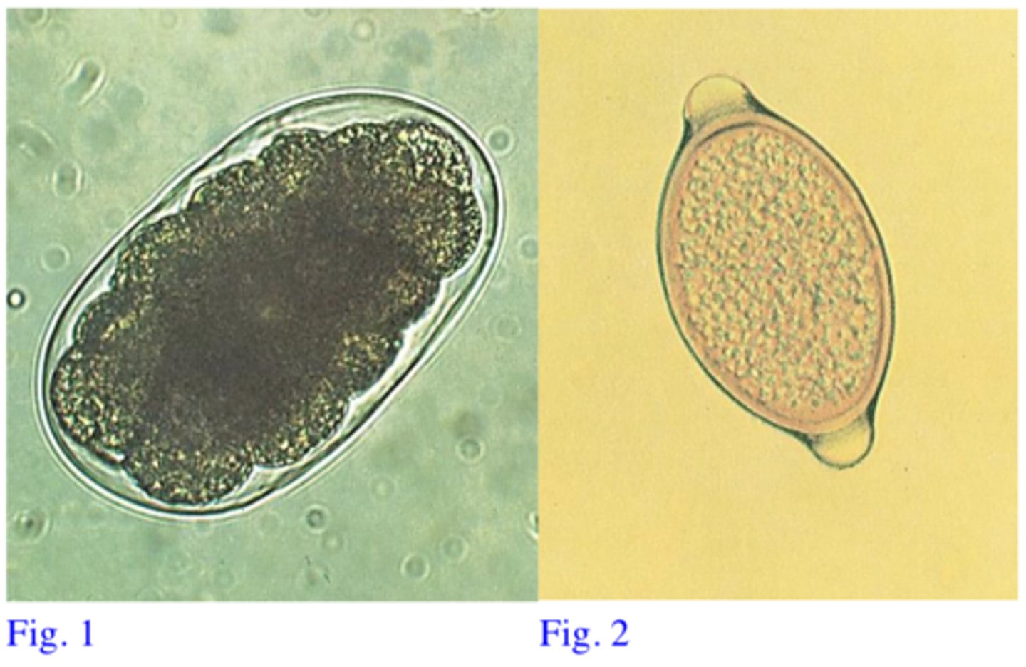 <p>Station 14:</p><p>Q3: Match the eggs shown in Fig. 1 and Fig 2 with each of the two parasites</p>