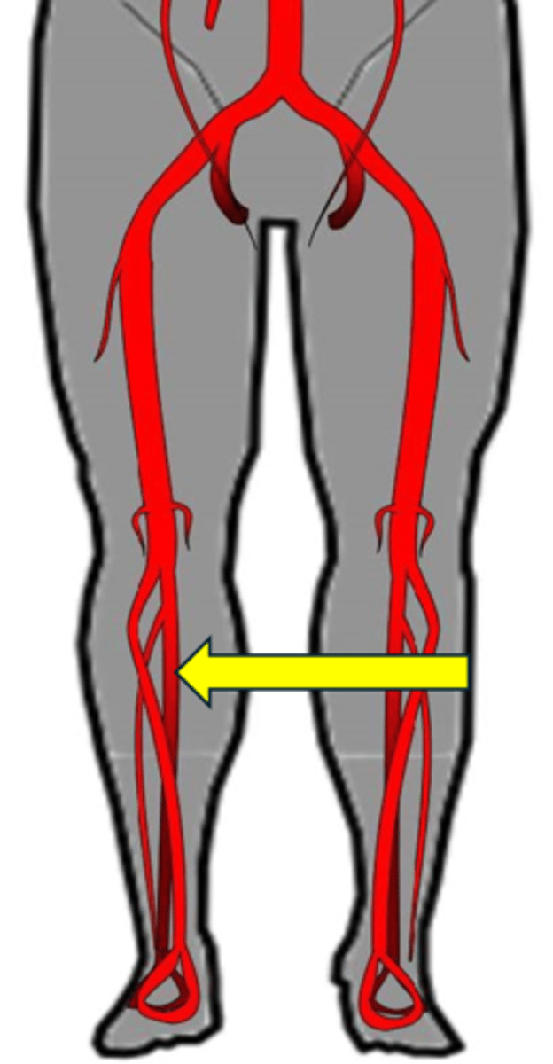 <p>Name this red vessel.</p>