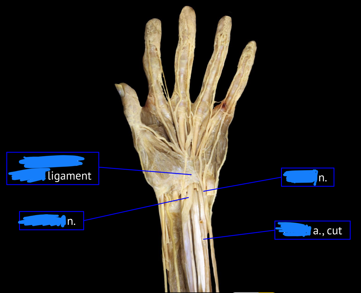 <p>left nerve</p>