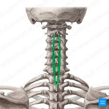 <p>Action: Bilateral extension, Ipsilateral lateral flexion, Ipsilateral rotation <strong>of the spine</strong></p><p>Exercise: Bent over row</p><p>Stretch: Child's pose</p>