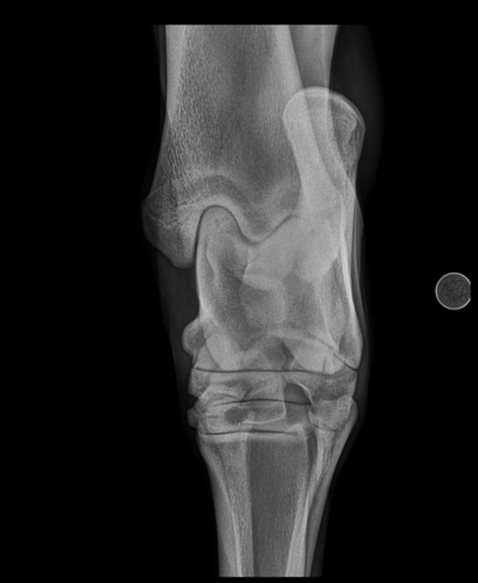 <p>Name the view and the anatomical region within the radiograph</p>