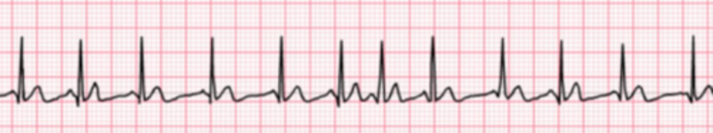 <p>Name the rhythm</p>