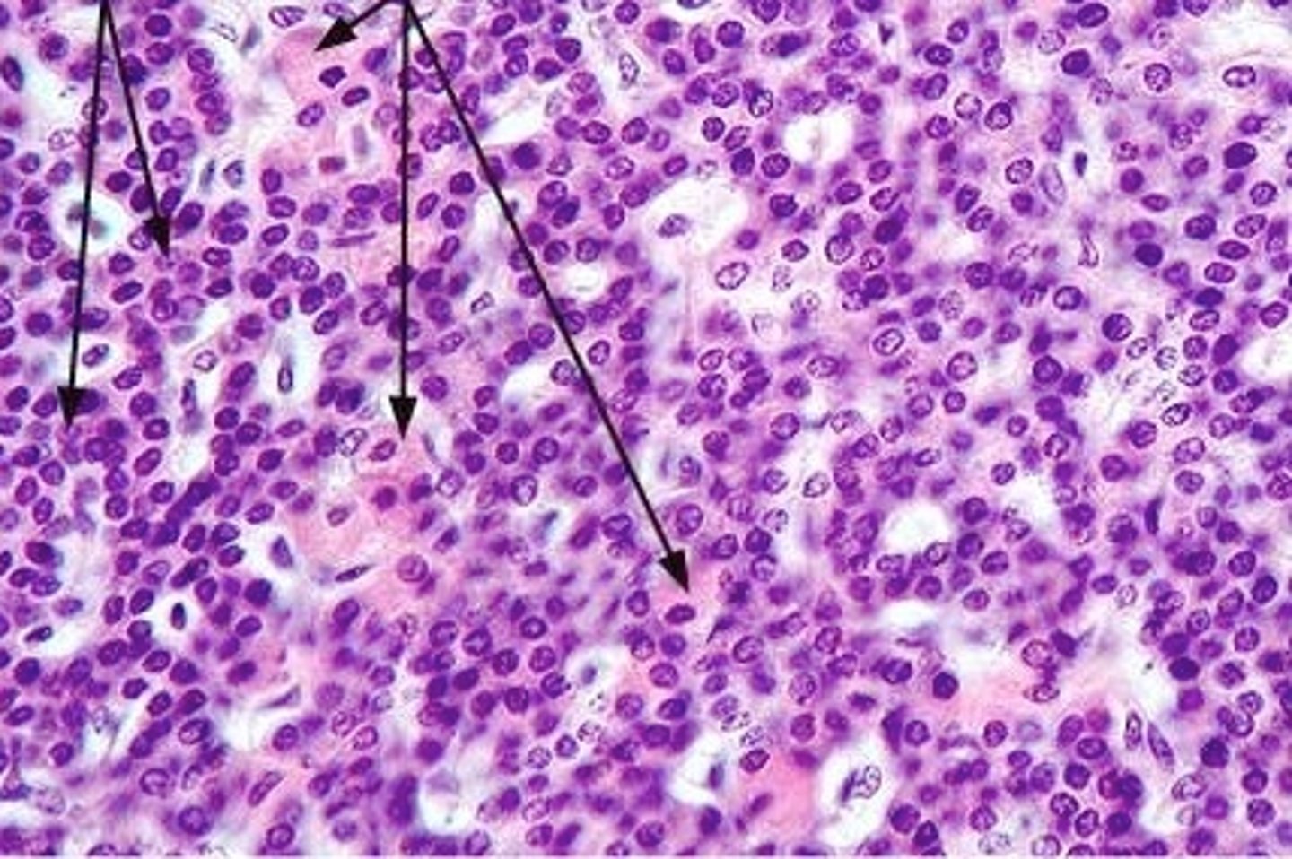 <p>First set of arrows</p><p>Most numerous cell type, smaller</p>