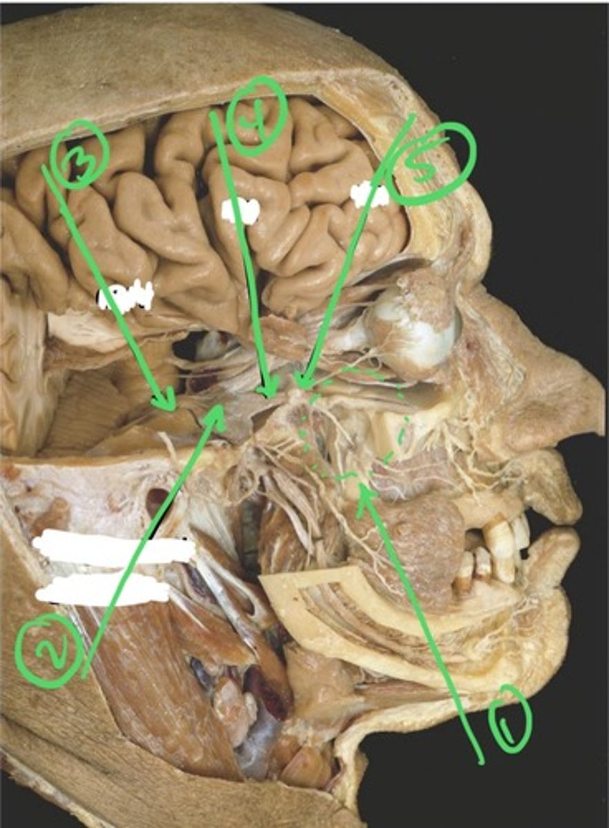 knowt flashcard image