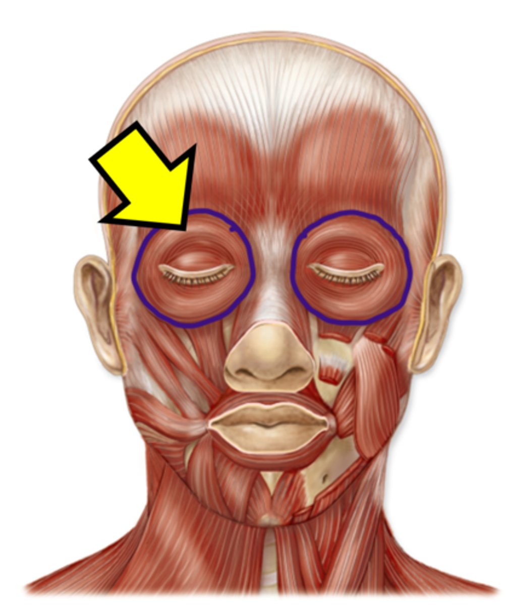 <p>Name the muscle.</p>