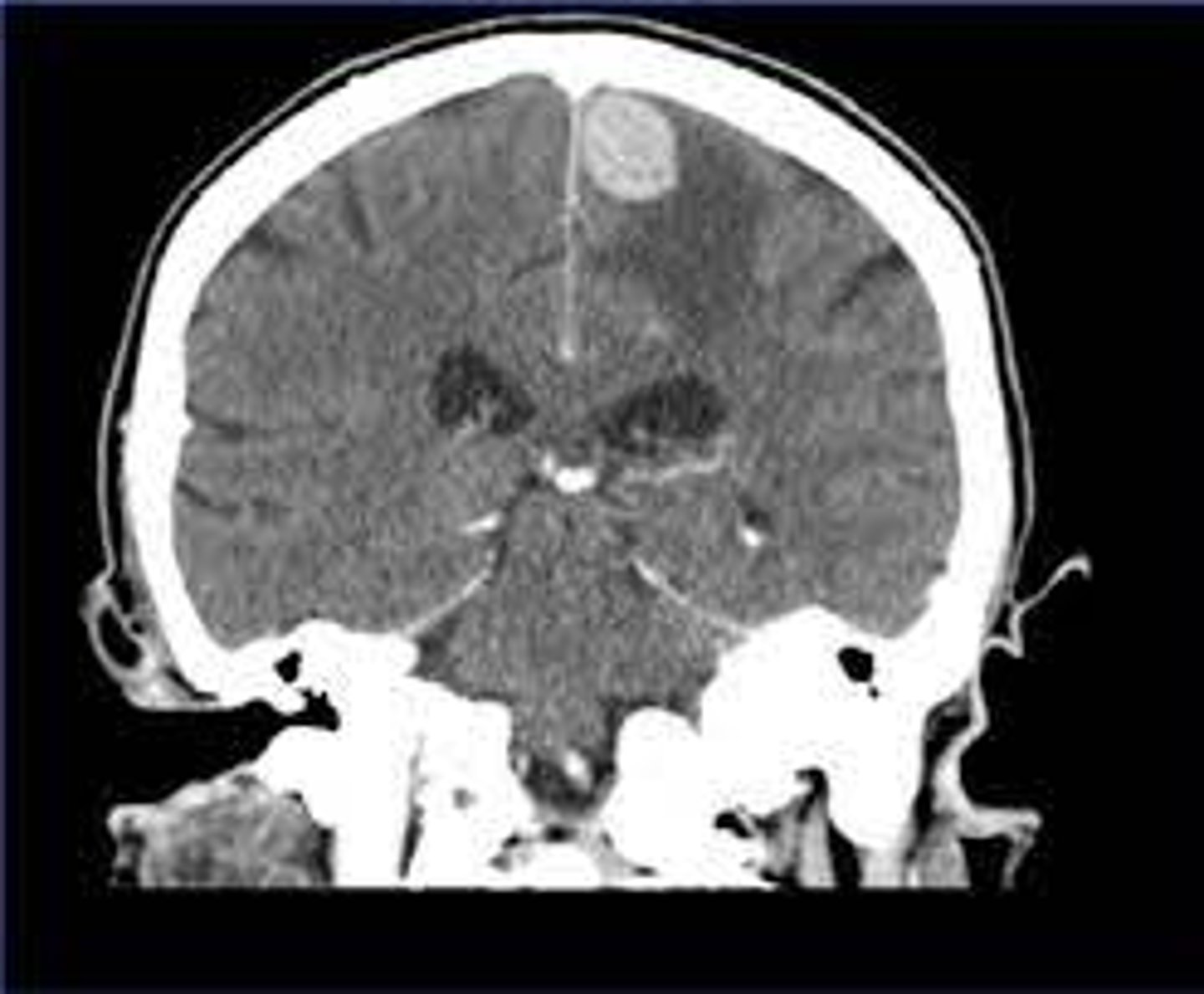 <p>ID the plane of view:</p>