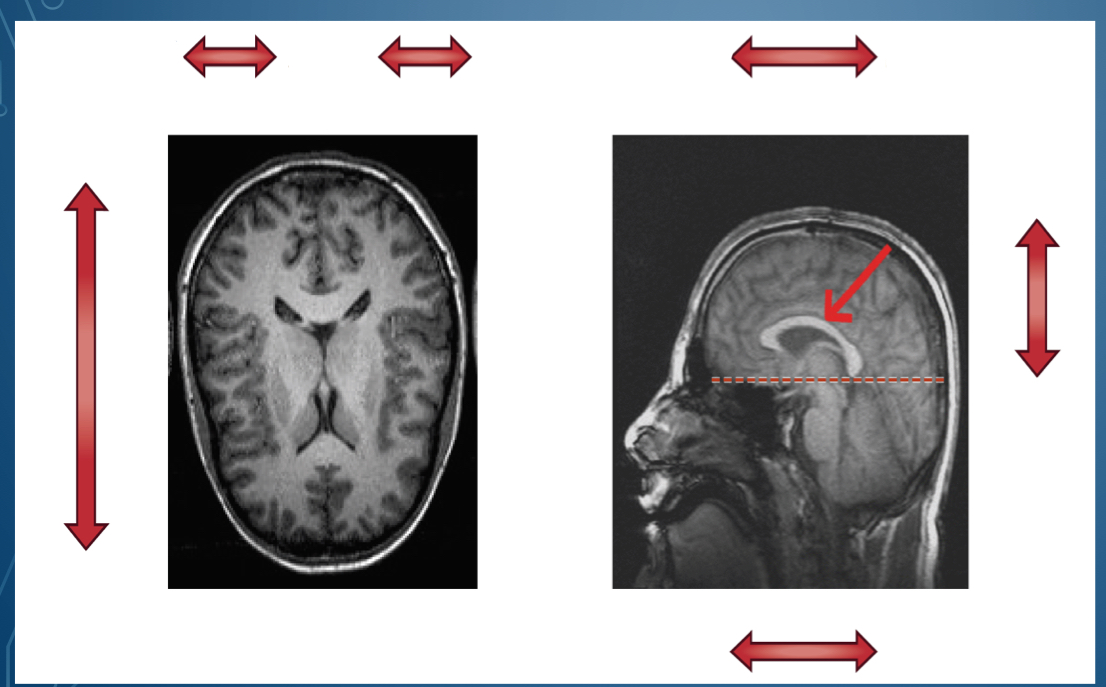 <p>Directions: of anatomy Where is ventral located</p>