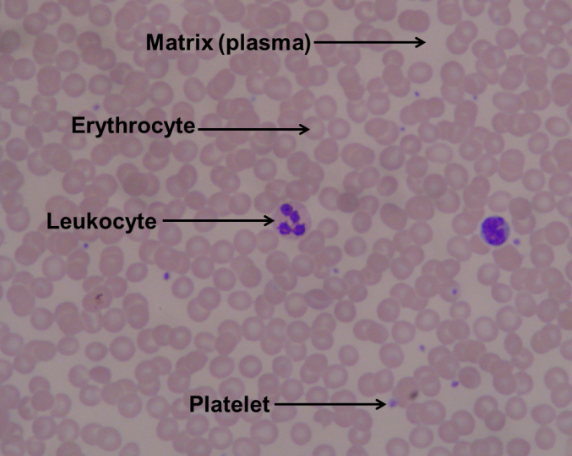 <p>connective tissue; ECM is fluid plasma; contains erythrocytes, leukocytes, platelets; located within blood vessels and chambers of the heart</p>