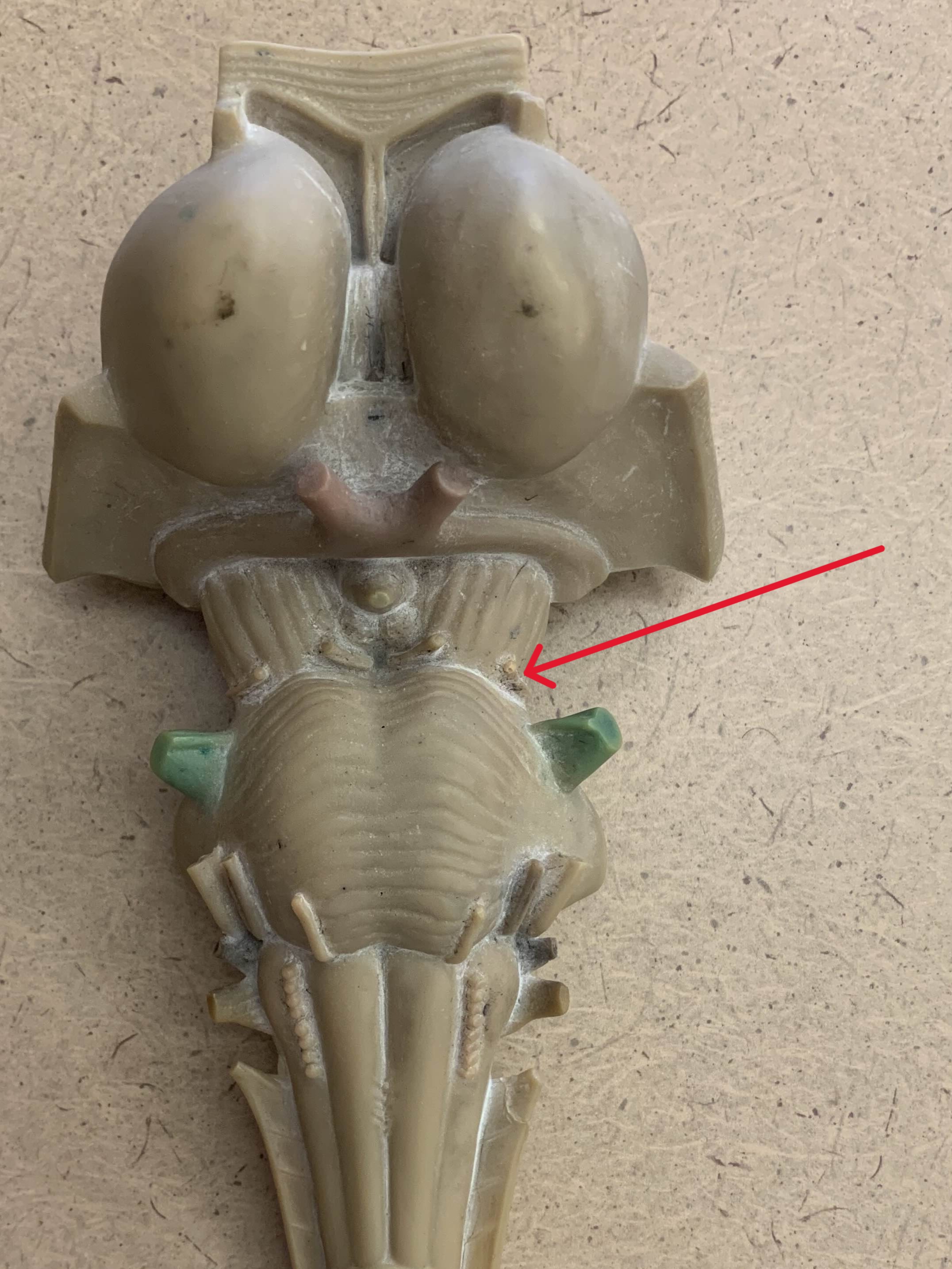 <p>Which nerve of the brain is:</p><ul><li><p>Superior to pons</p></li><li><p>Lateral to oculomotor</p></li></ul><p></p>