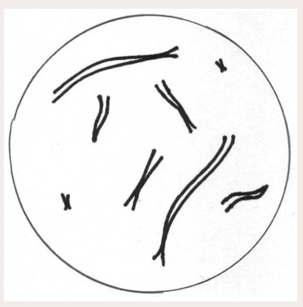 <p>What is the haploid number of this cell? Is it haploid or diploid?</p>