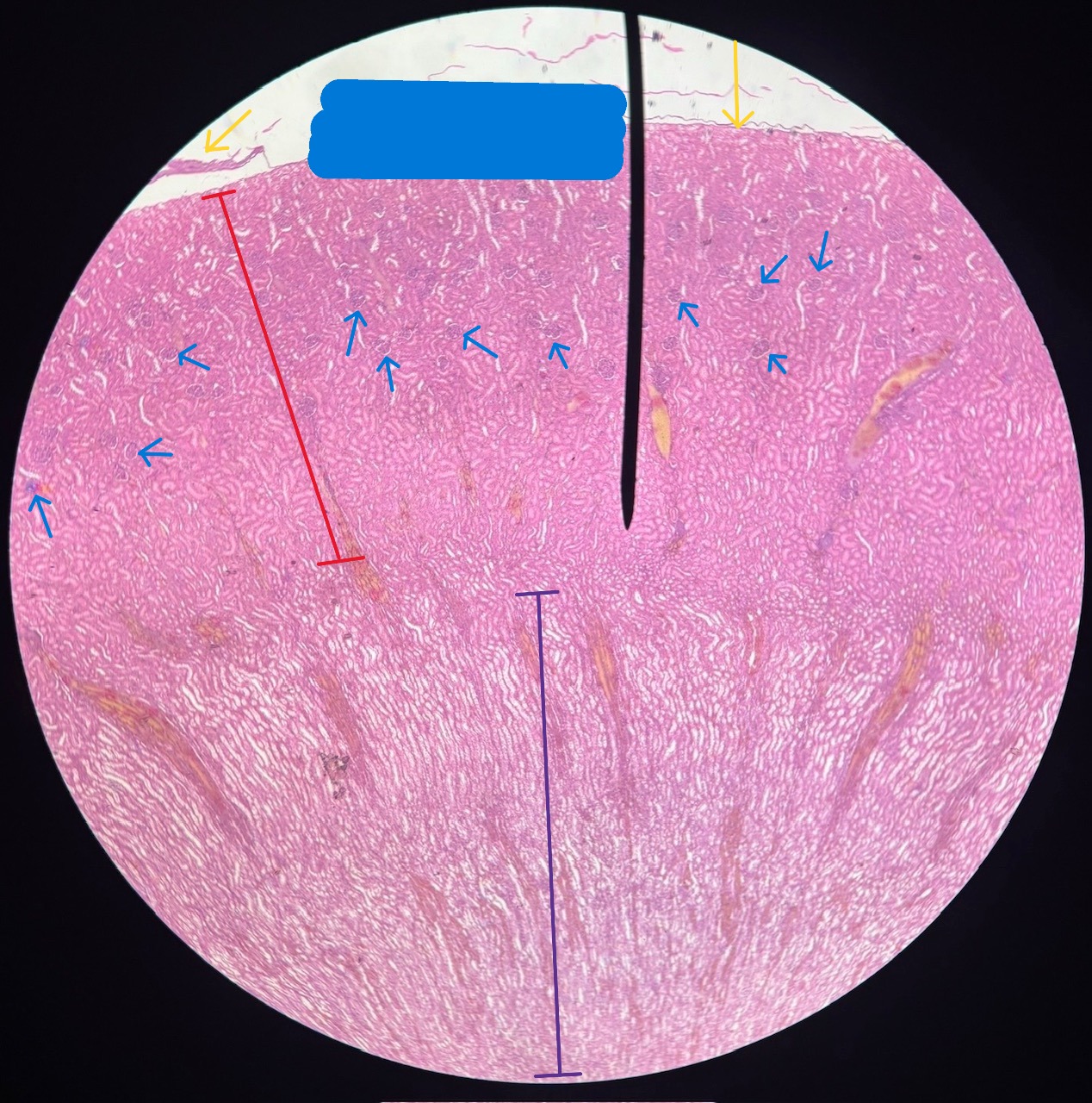 <p>Organ?</p><p>Outermost layer surrounding organ? (yellow arrows)</p><p>Structure at blue arrow?</p><p>Red area (region)?</p><p>Purple area (region)?</p>