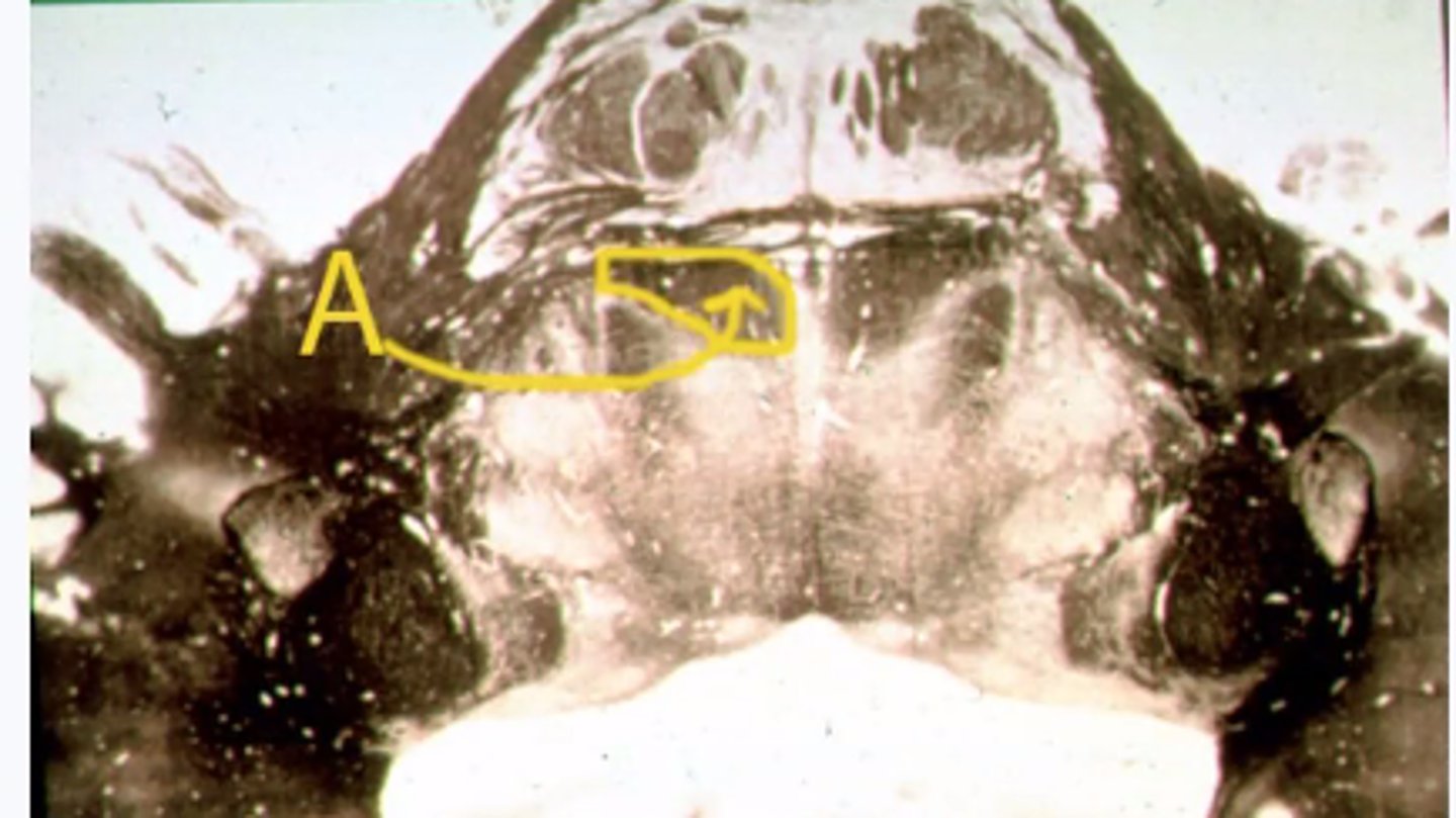 <p>Identify the structures indicated by the outline and letter "A"</p>