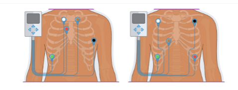 <p>Five-lead EKG</p>