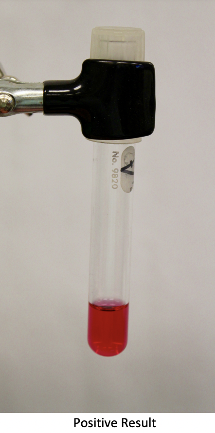 <p>Classification: Differential medium </p><p>Ingredients: Yeast extract, potassium phosphate, urea, phenol red</p><p>Lab Usage: Formulates test for fast urease postive organisms</p><p>Results: liquid red if positive </p>