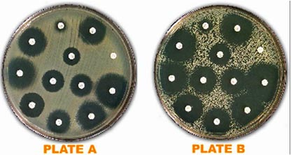 <p><span>These photos represent testing of the same Enterobacter cloacae isolate on the same day under the same testing conditions but with two different inoculum suspensions. &nbsp;Note the different appearances of the lawns of growth on each plate. &nbsp;Which plate is acceptable to read?</span></p>