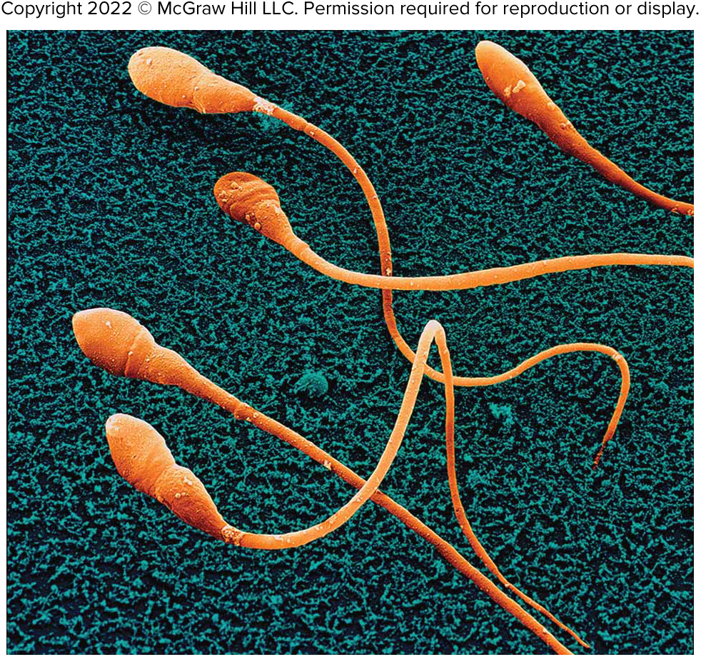 <p>Flagella</p>