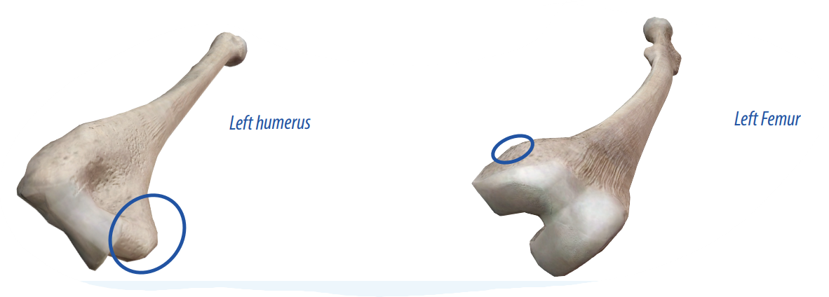 <p>A rounded projection that sits on top of the condyle and allows connective tissues to connect to the bone.</p>