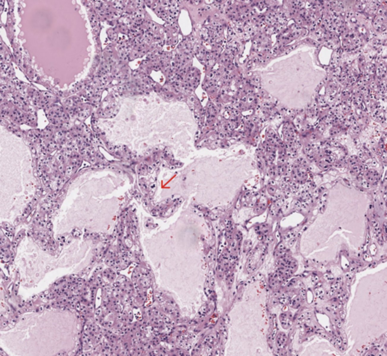 <p>Kidney</p>