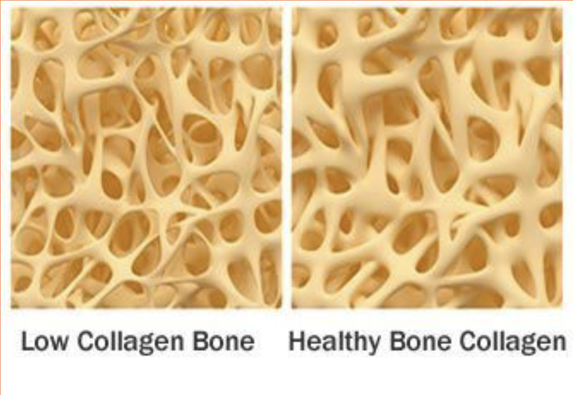 <p>Collagen is a series of rope-like fibers that provide a base network. This gives bone its flexibility</p>