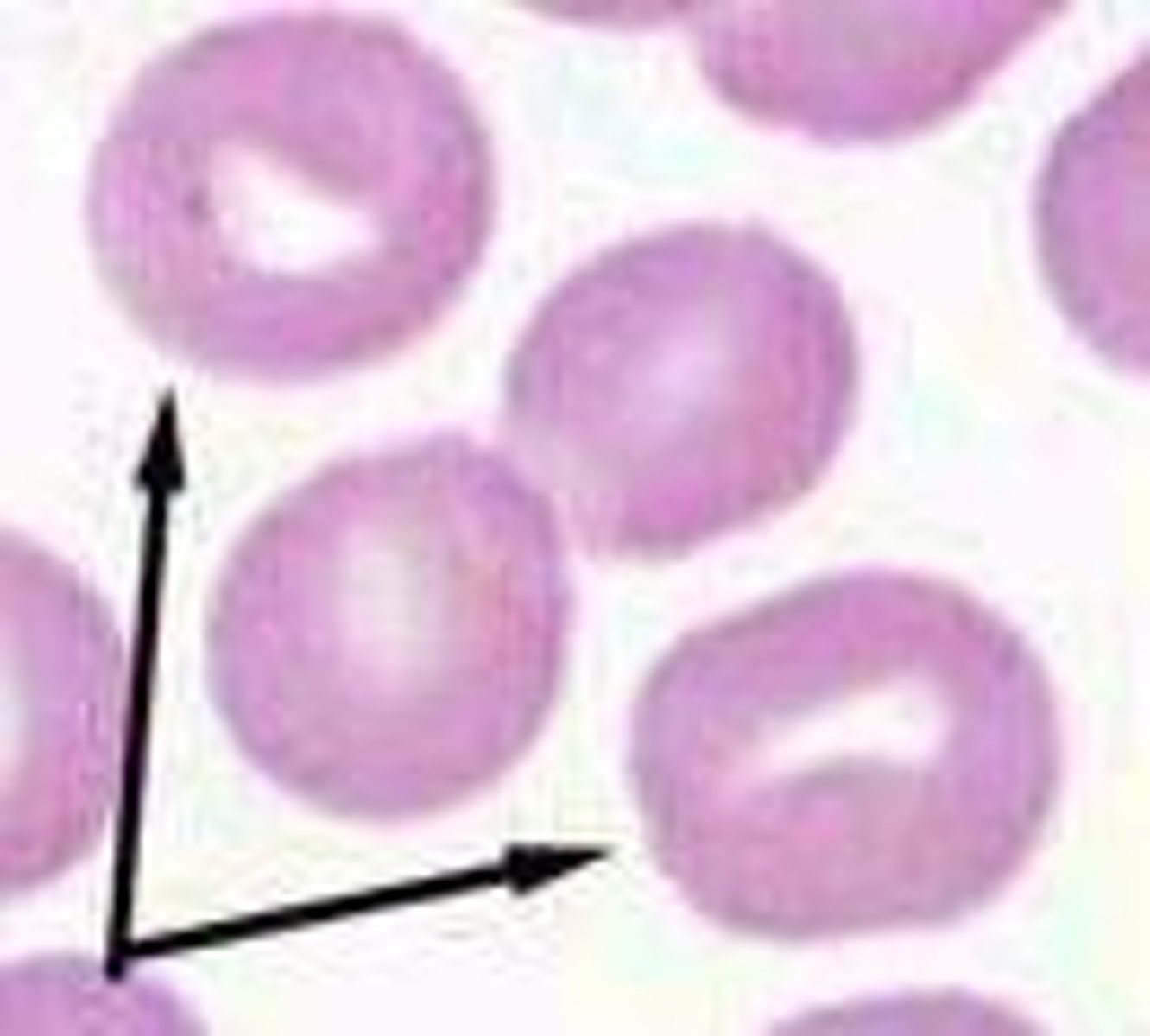 <p>Folded lepatocyte cells that hae a transverse raised fold that extends across the center of the cell as well as a clear pale region in the center of the cell</p>