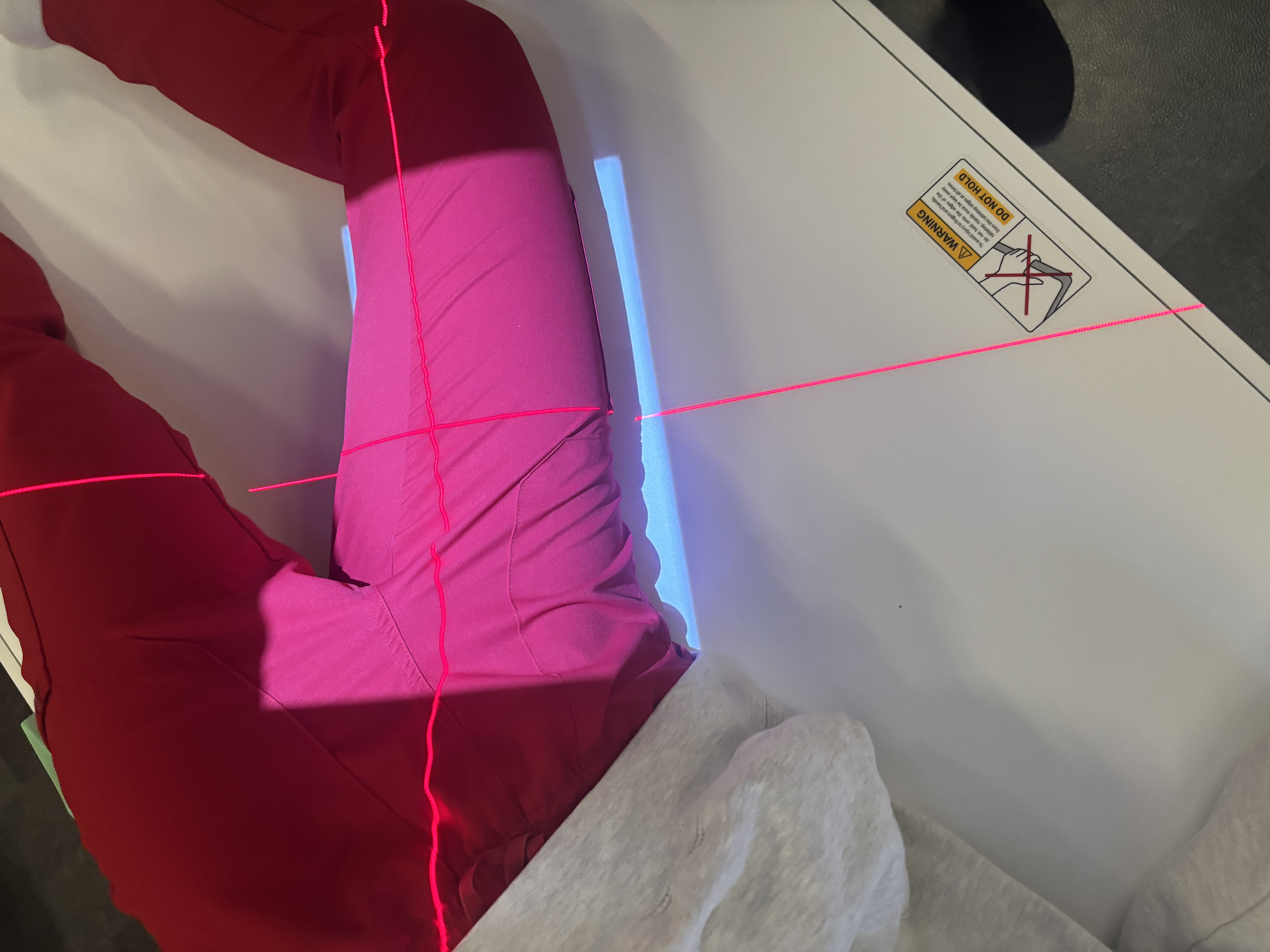 <p>Lateral Mid &amp; Proximal Femur</p>