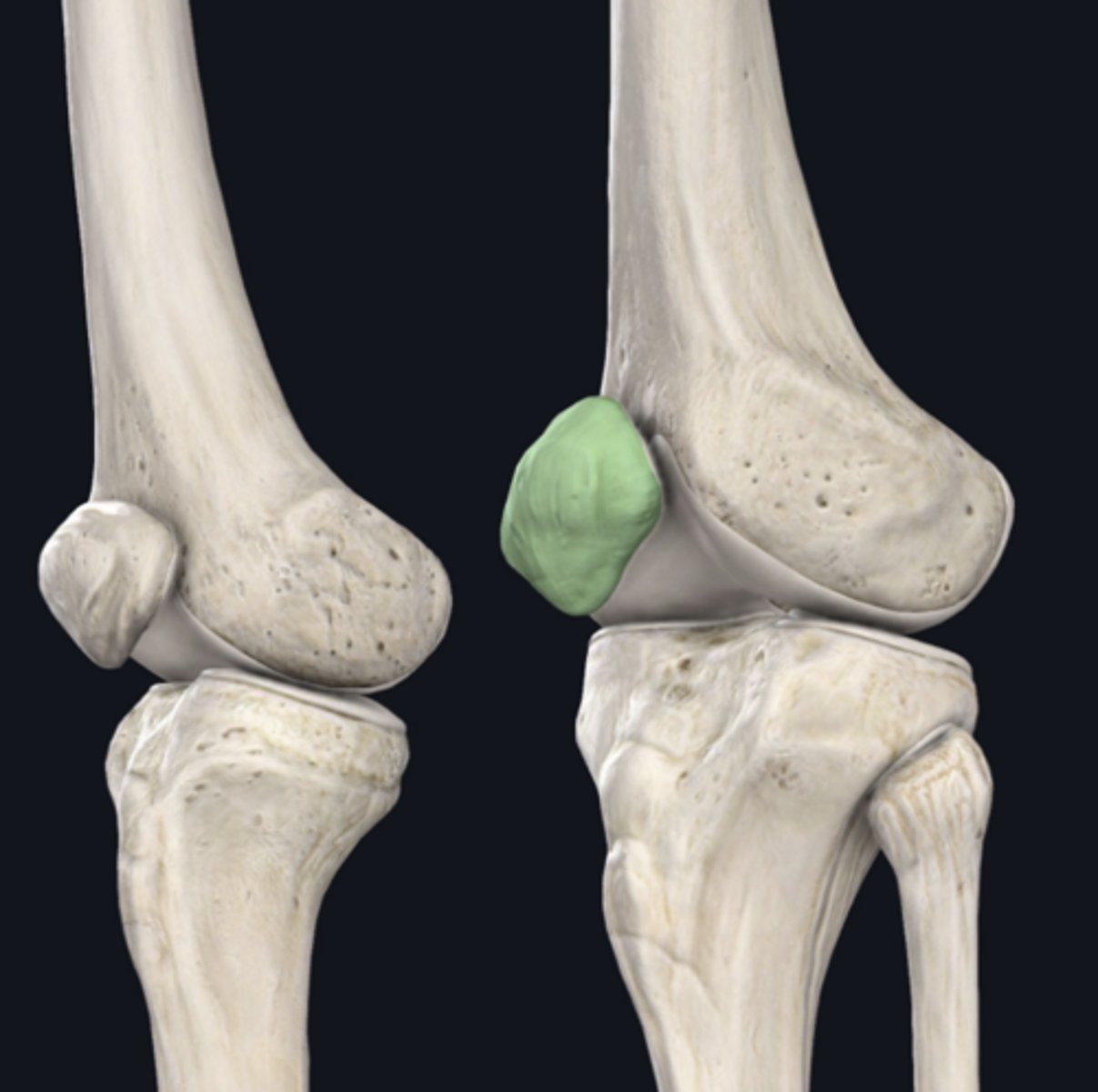 <p>Identify the bone indicated in green. (Free response)</p>