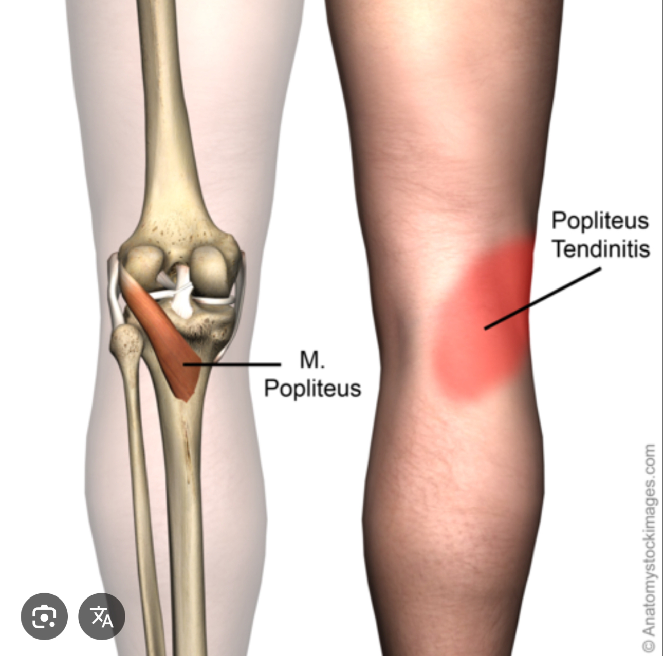 <p>Structure located behind the knee joint</p>