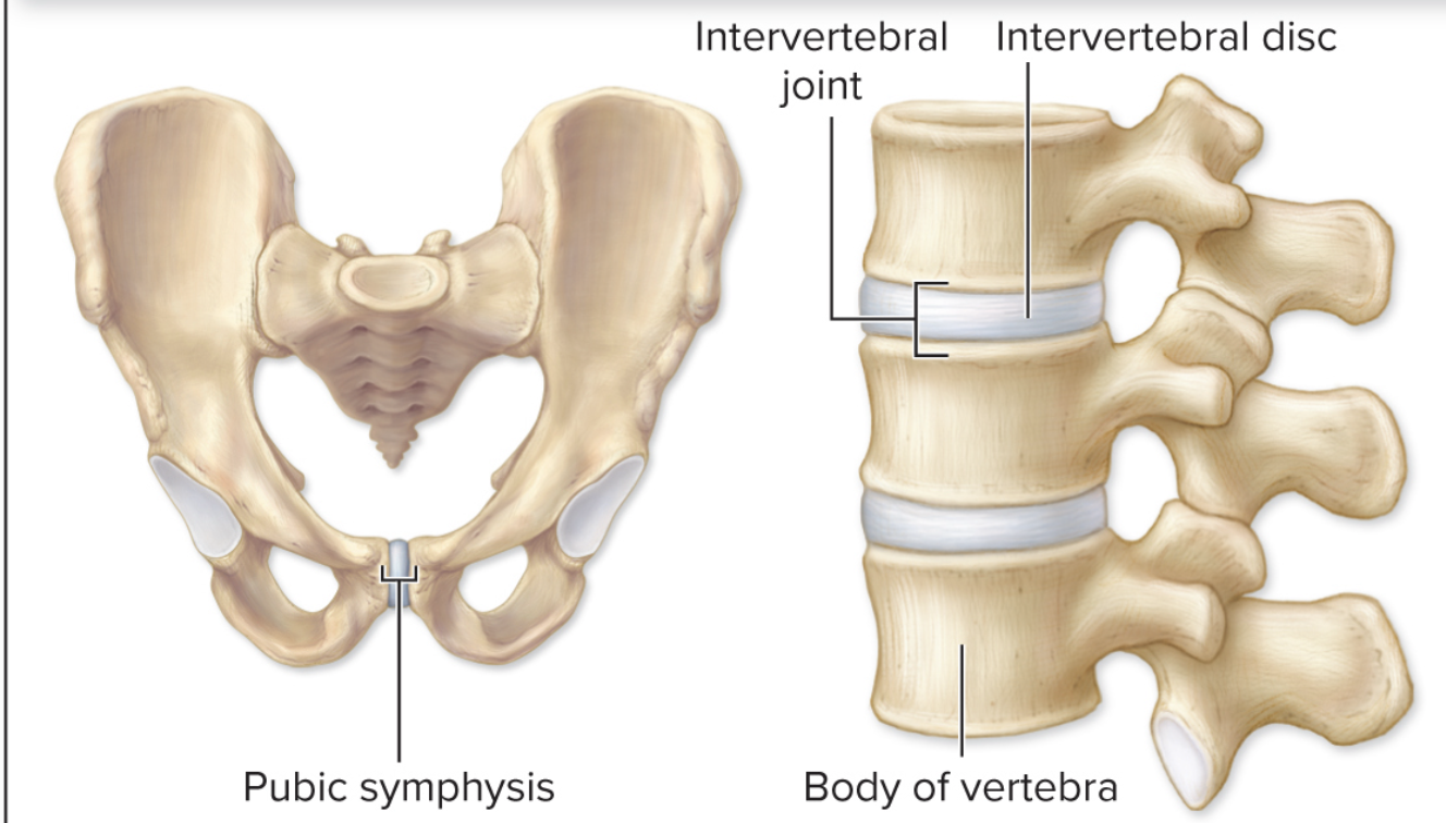 <p>What kind of joints can be found in this image?</p>