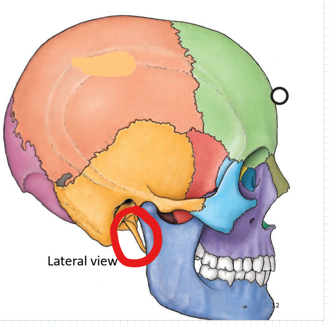 term image