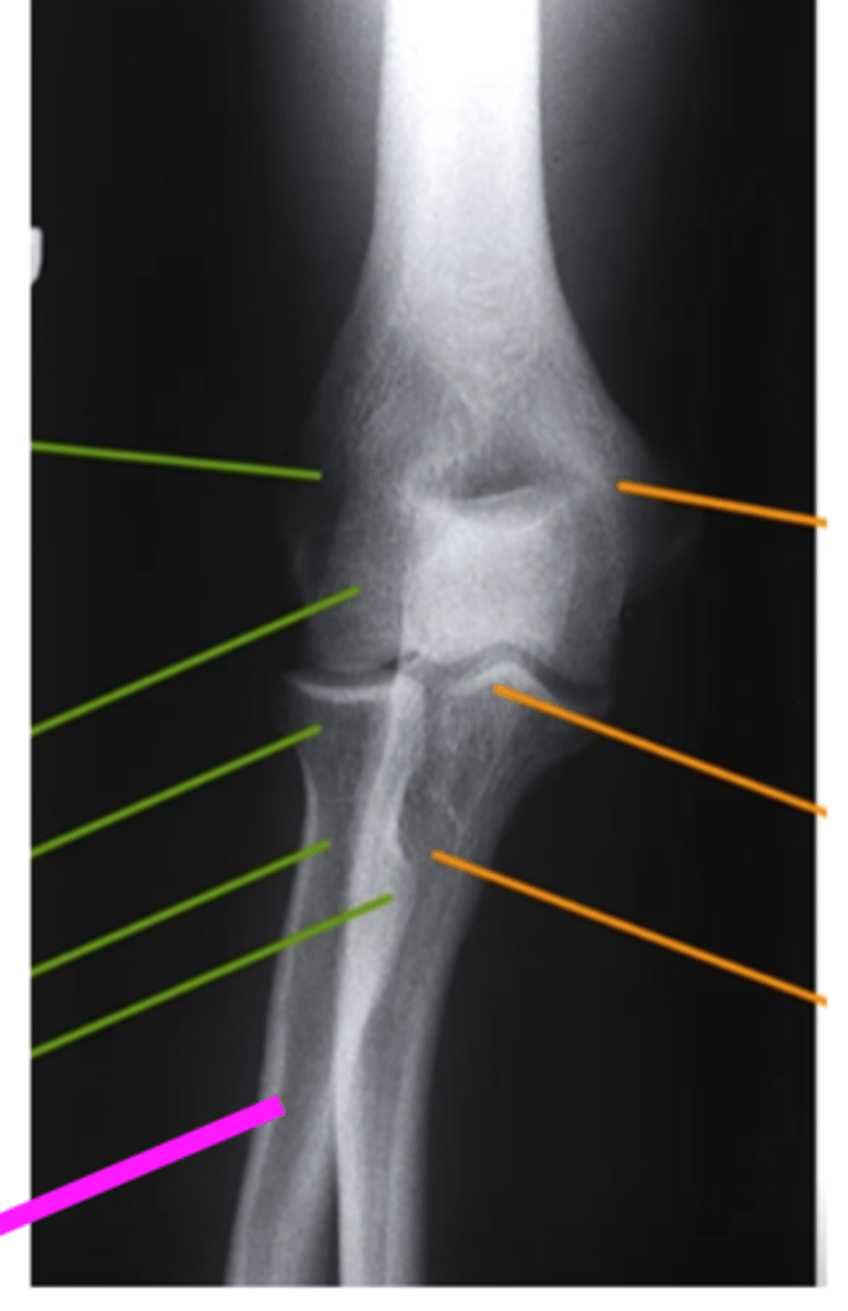 <p>what does the pink line point to?</p>