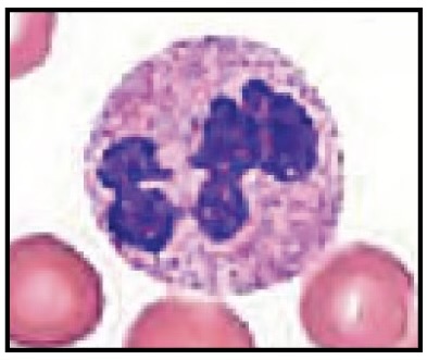 <p>Identify this leukocyte</p>