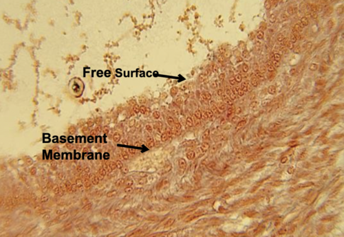 type of epithelial tissue, function, and location?