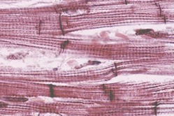<p>What type of muscle is this?</p>