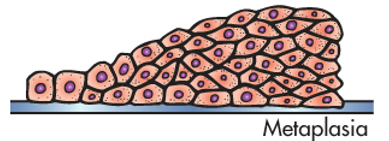 <p><span>Change in cell type from one normal form to another normal form known by the body.</span></p><p><br></p>