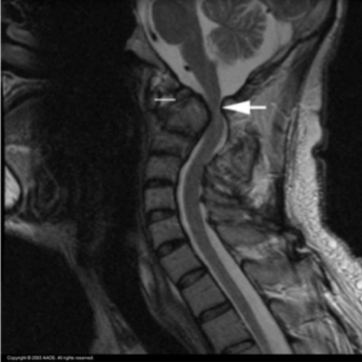 <p>What is the issue?</p>