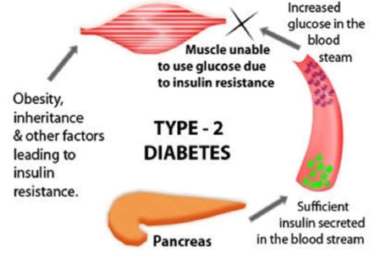 <p>- increased tissue resistance (caused by obesity), causes low adiponectin & high cytokine presence</p><p>- adiponectin is low b/c of high WAT accumulation, which also causes cytokine release and therefore a mild state of inflammation</p><p>- altogether causes insufficient production of insulin as tissues cannot produce insulin</p>
