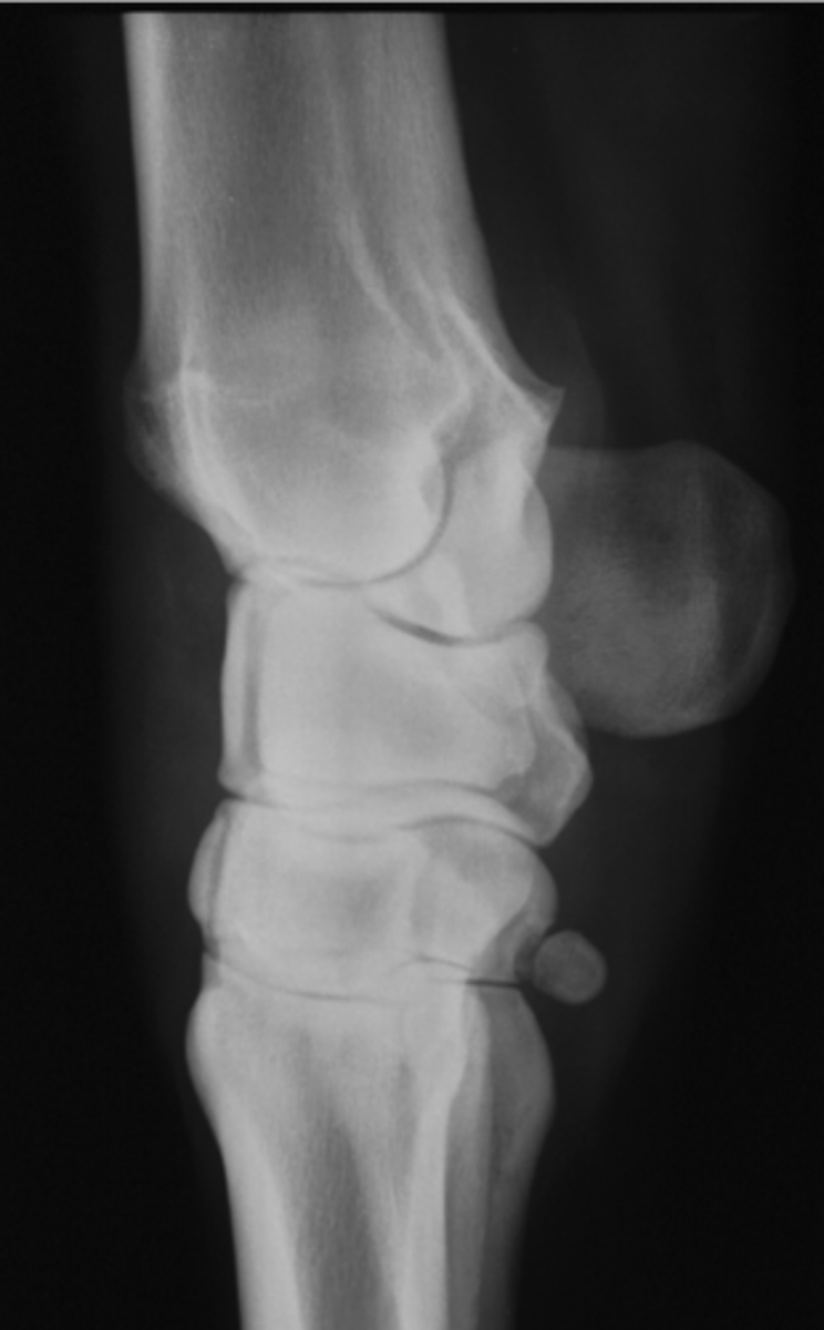 <p>ID joint and view</p>