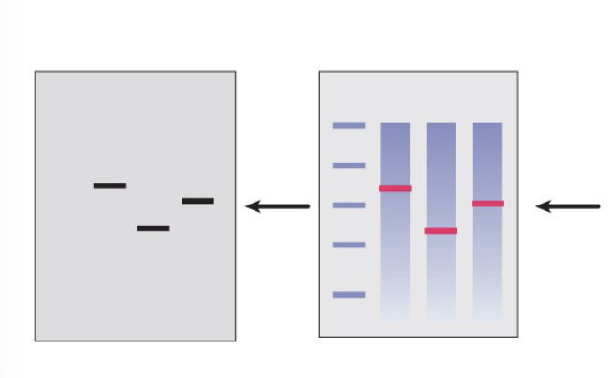 <p>expose the membrane to x-ray film to visualize the mRNA expression levels of the target gene</p>