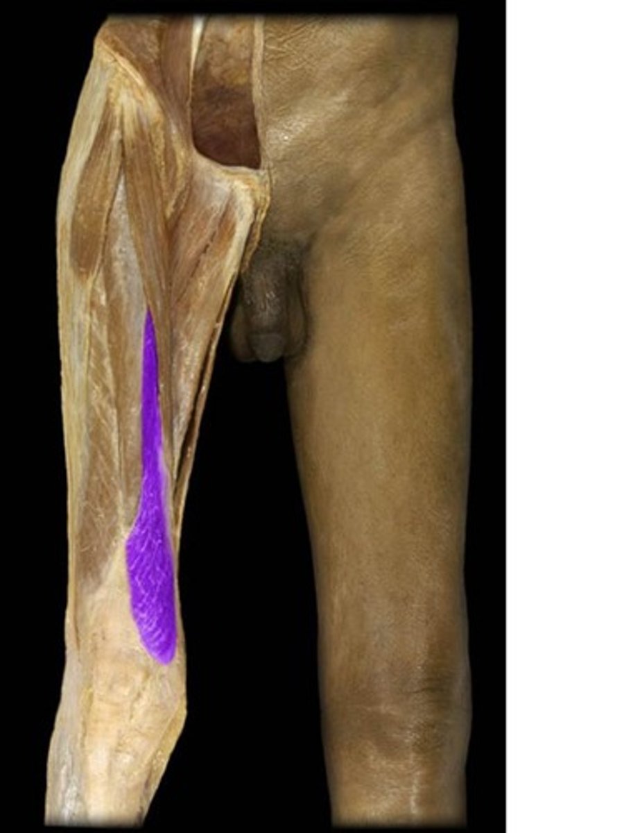 <p>Origin: Ischial tuberosity</p><p>Insertion: Patellar ligament to tibial tuberosity</p>