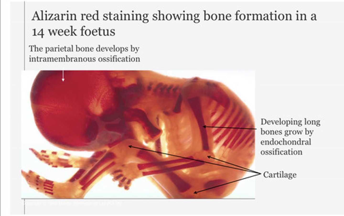 <p>Intramembranous ossification</p>