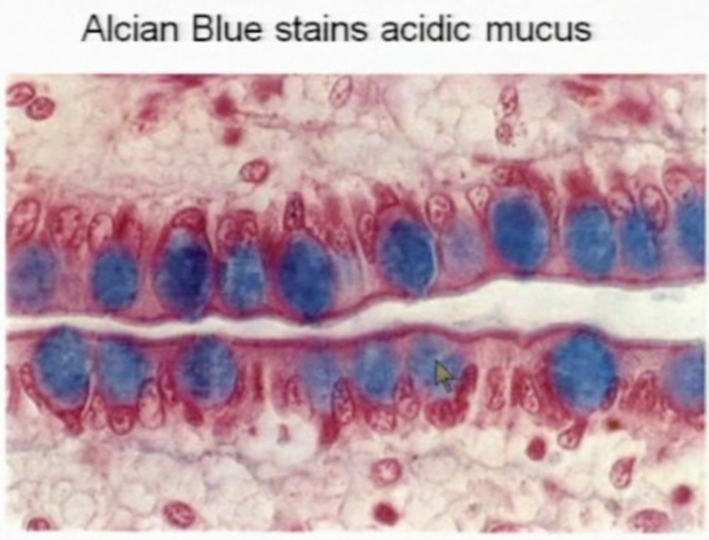 <p>mucin or mucopolysaccharides in tissue section</p><p>3 multiple choice options</p>