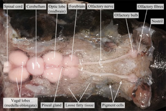 <p>Circulatory System </p>