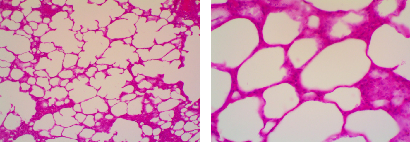 <p>Simple squamous epithelium</p>