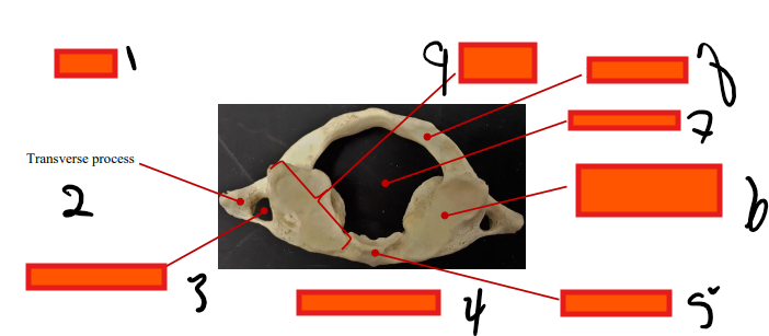 <p>#2</p>