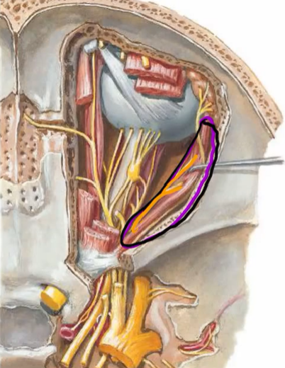 <p>CN VI - Motor</p><p>o: pons → muscle</p><p>p: superior orbital fissure → CN III, CN IV, V1, VI</p><p>f: lateral rectus m. only</p>