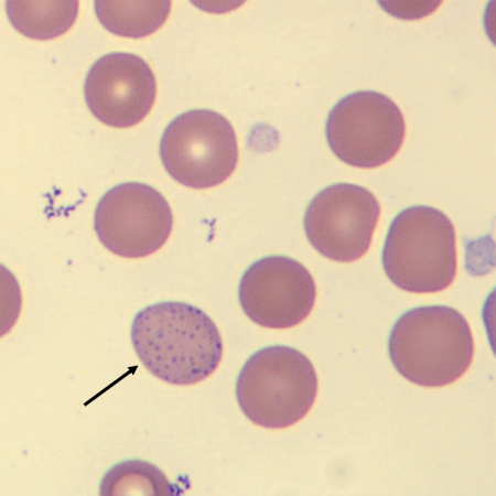 <p>What is the inclusion in this erythrocyte?</p>