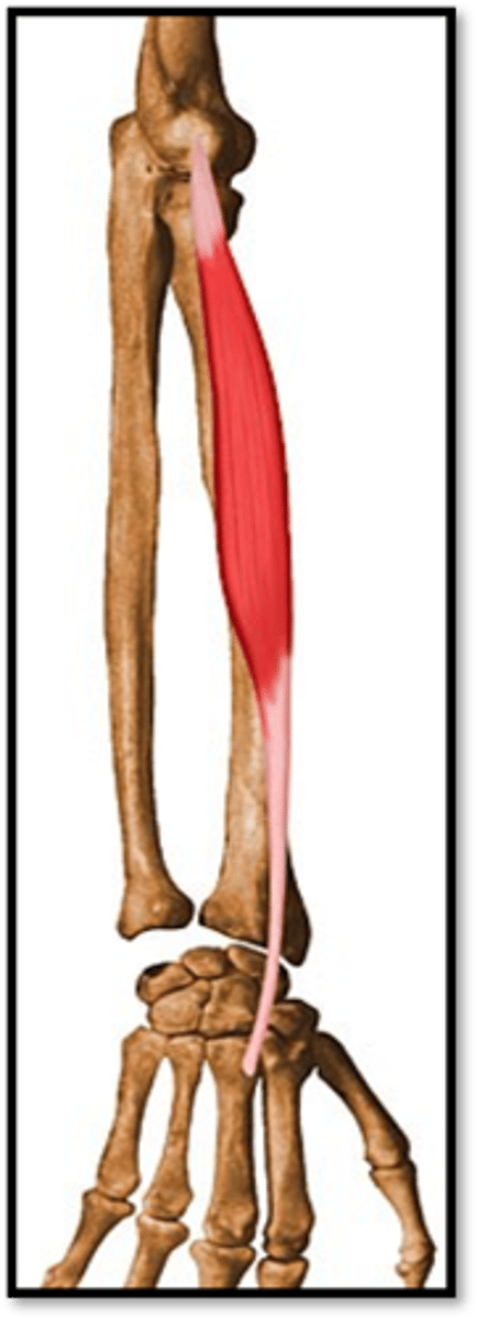 <p>What is the action of Extensor Carpi Radialis Brevis?</p>
