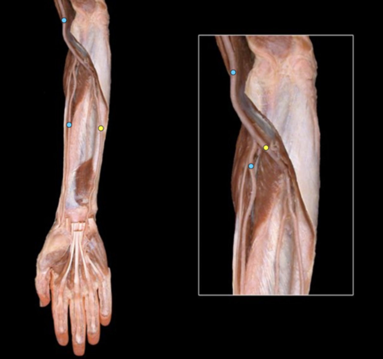 knowt flashcard image