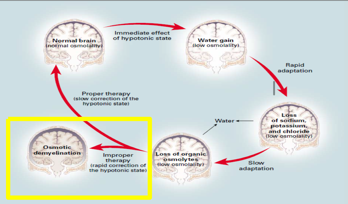 <p><strong>Pathophysiology</strong></p>